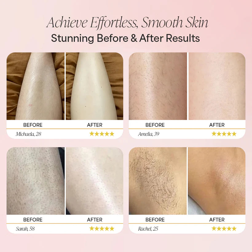 GlowAura™ Trimmer 2.0